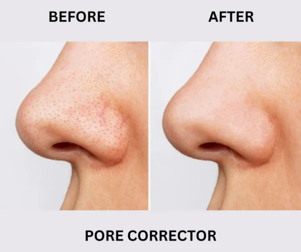 PORE CORRECTOR (Blackhead And Whitehead Solution) - Image 7