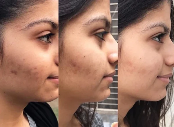 Vitamin C + Niacinamide Brightening Kit (PACK OF 4) - Image 3