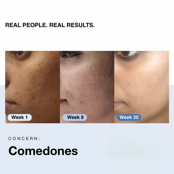 PORE MINIMISING BUNDLE OFFER (PACK OF 4) - Image 5