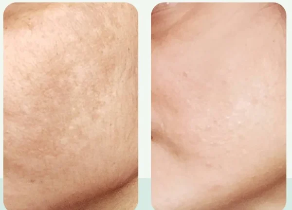 Vitamin C + Niacinamide Brightening Kit (PACK OF 4) - Image 9