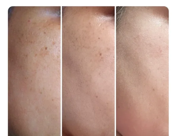Vitamin C Weightless Brightening Moisturizer SPF 45 (no white cast) - Image 5