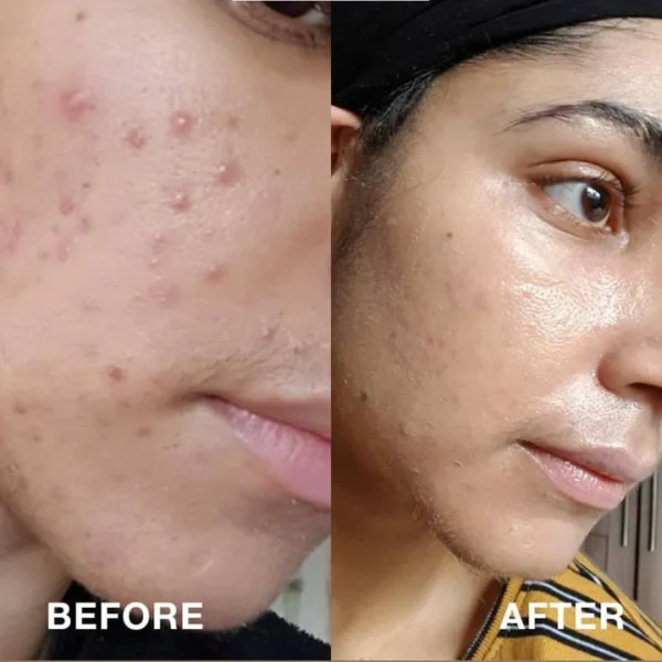 PORE MINIMISING BUNDLE OFFER (PACK OF 4) - Image 2