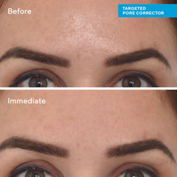 PORE CORRECTOR (Blackhead And Whitehead Solution) - Image 10